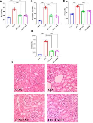 Nephroprotective mechanisms of Rhizoma Chuanxiong and Radix et Rhizoma Rhei against acute renal injury and renal fibrosis based on network pharmacology and experimental validation